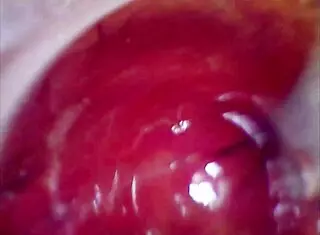 Real Pussy Orgasm Contractions With Cum Inside Under Microscope