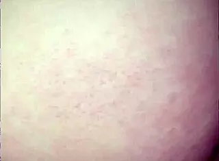 Teen Girl Takes Monster Cock Backshots And Creampie